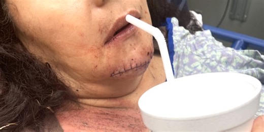 ‘I was shaking’: S.C. rodeo stampede spurs chaos, injuries