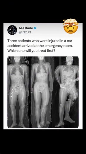 This is hard…. #xray #emergencyroom #doctor | emergency room