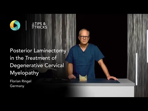 Posterior Laminectomy for Degenerative Cervical Myelopathy by Florian Ringel #laminectomy