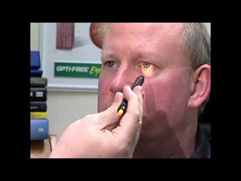 Optometry Skills : 004 Pre-refraction - Assessment of pupil function