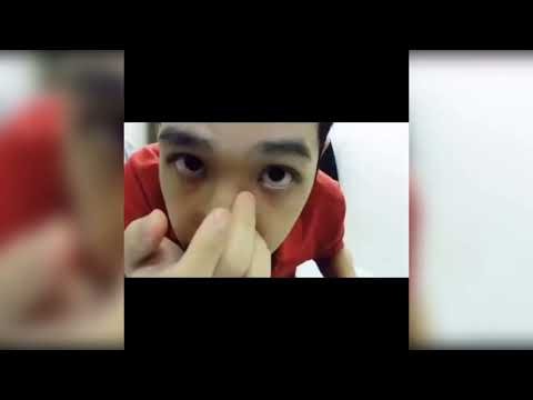 Best Pimple Popping Videos SATISFYING PIMPLE POPPING & BLACKHEAD REMOVAL COMPILATION #19