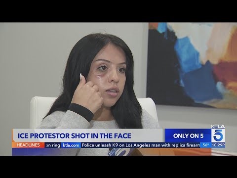 ICE protestor shot in face by police in L.A.