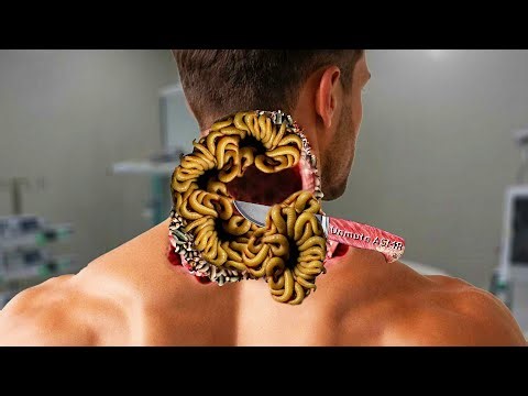 ASMR Man Back Neck Treatment Insects, worms & Bees Cleaning | severely injured | Unmute asmr