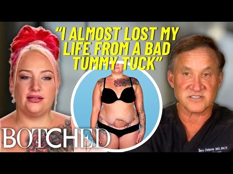 See Why Dr. Dubrow Called Maranda's Botched Tummy Tuck “Clinical Bullsh*t” | Botched | E!