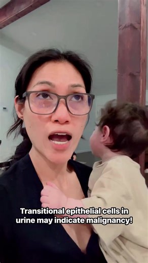 Transitional Epithelium Cells in Urinalysis: A Cancer Indicator