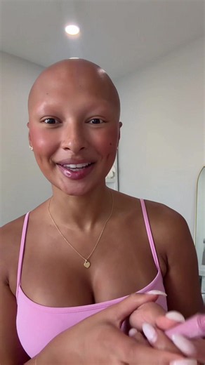How I Lost My Hair: Full Alopecia Storytime