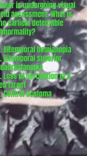 VISUAL FIELD ASSESSMENT