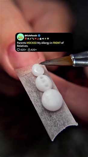 Struggling with Allergy Denial: A Personal Account