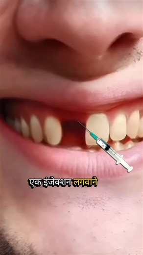 Sandeep Singh on Instagram: "Can lost human teeth grow back naturally? Scientists in Japan have developed an experimental injection that may allow tooth regeneration. This injection works by blocking a protein called USAG-1, which normally prevents new teeth from growing. In animal studies, researchers successfully observed new tooth formation, and now the research is moving toward human clinical trials. If proven safe and effective, this discovery could reduce the future need for dental implant