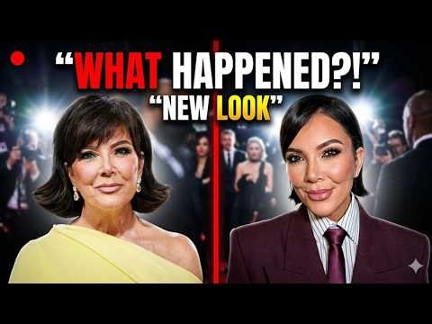 What Happened to Kris Jenner’s Face? New Photos Spark Concern 👀