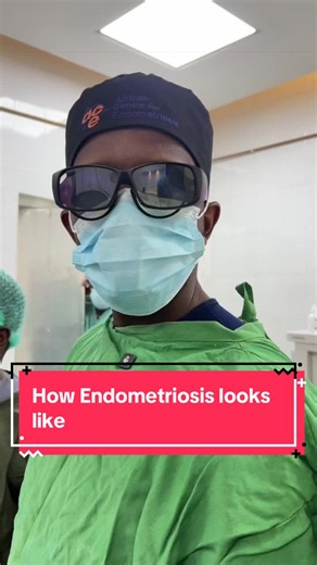 Endometriosis is so much more than just a 'bad period.' It’s a chronic condition that can affect everything from daily energy levels to long-term health. Knowledge is power let’s normalize talking about it. #endometriosis #endometriosisawareness #creatorsearchinsights