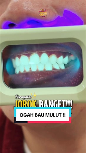 WAJIB punya dan pake biar 2026 bebas bau mulut 🤣 @Colgate Palmolive Indonesia #OpticWhitePurple#OpticWhitePurplee