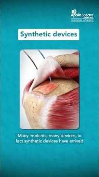 Advances in Rotator Cuff Tear Treatment_by Dr. Abhishek Kumar Mishra