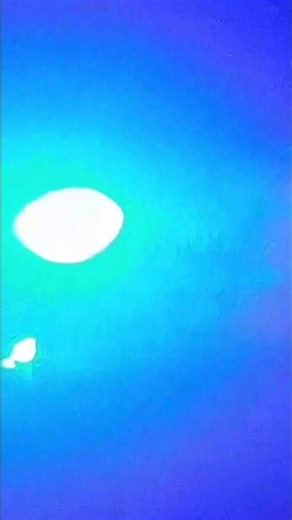 ASMR laser therapy eye exam 👀 Full video on my Channel 💕 #asmr #shorts #eyes #therapy #exam #tiktok