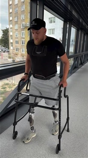 Amazing Recovery! Double Above Knee Amputee Learning to Walk with Prosthetic Legs