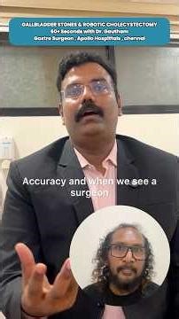 GALLBLADDER STONES & ROBOTIC CHOLECYSTECTOMY!