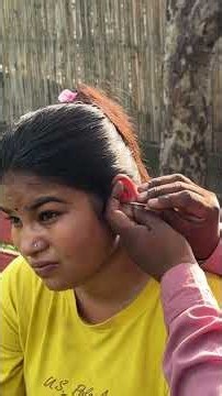 India Street Ear Wax Removal 😱 | Satisfying Ear Cleaning
