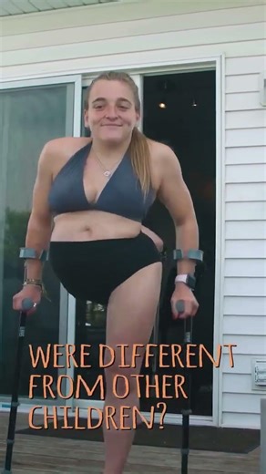 We were born as one - now we're thriving as two ✨ #borndifferent #conjoinedtwins #sisters #twins #yt