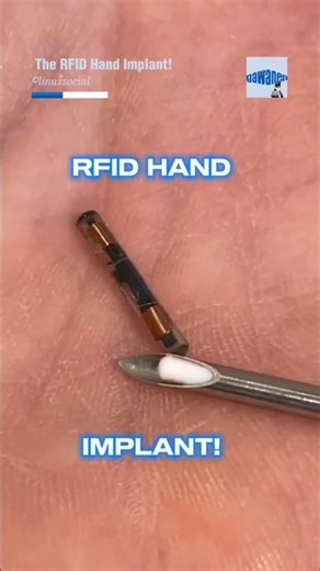 Become a Cyborg: The RFID Hand Implant!