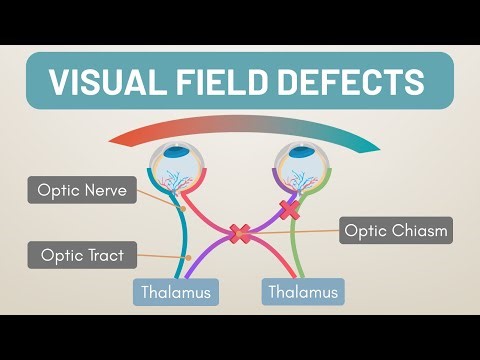 Visual Field Defects Made Easy | Anopias & Hemianopias