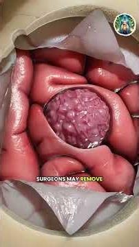 Craniotomy Brain Surgery 😮 3D Animation Explained!