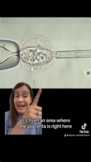 How Embryo Biopsy Works | IVF Genetic Testing (PGT-A), Gender & Chromosome Screening