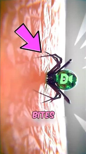 If You Ever Get Bitten by a Spider, Do This Immediately 😱