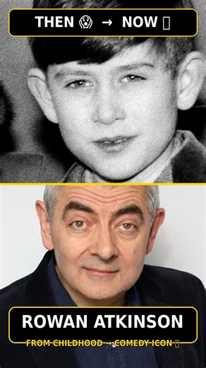Rowan Atkinson 😱 From Childhood to Mr. Bean Legend 😂 | Then & Now #Shorts