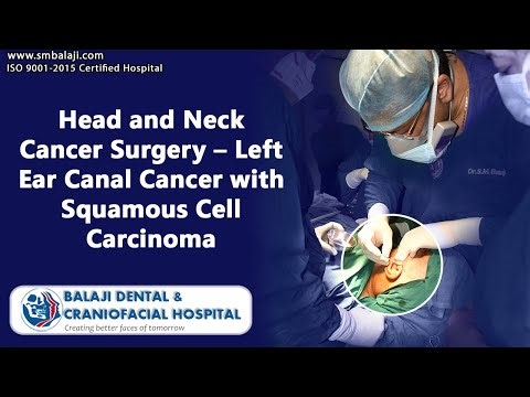 Head and Neck Cancer Surgery – Left Ear Canal Cancer with Squamous Cell Carcinoma
