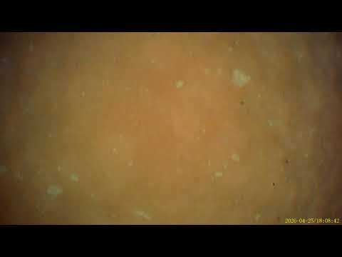 4/25/26 new blood sample making secondary chloros horse chimera version