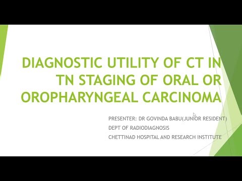 Govind Babu | DIAGNOSTIC UTILITY OF CT IN TN STAGING OF OROPHARYNGEAL CA #sonobuzz