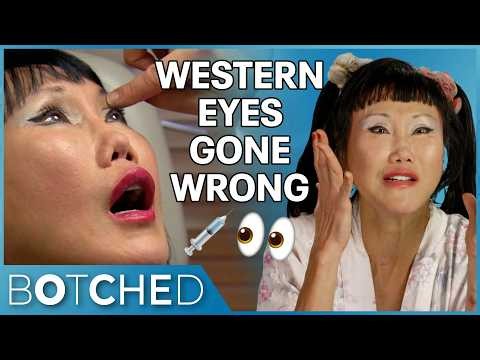 Cheryl Wants Her Eyes Back After Westernization and Black Market Fillers | Rejected By Botched | E!