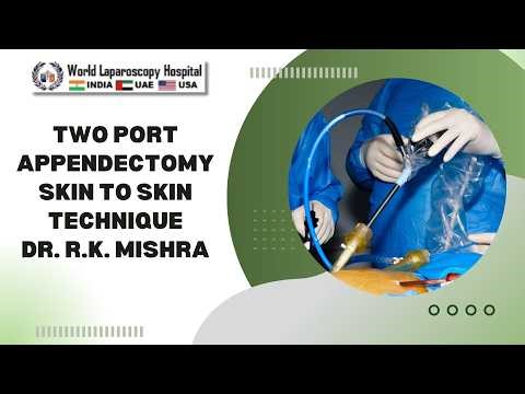 Two Port Appendectomy – Skin to Skin Technique Using Mini Alligator | Dr. R K Mishra | WLH
