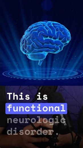 Why Doctors Get FND Wrong #FND #DisabilityAwareness #MedicalTruth