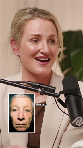 Can you get sun damage through windows? Dermatologist explains.