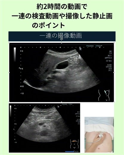 【#shorts 】2026年4月～5月超音波検査〈腹部エコーの一連の検査〉動画セミナー告知【#超音波検査 】