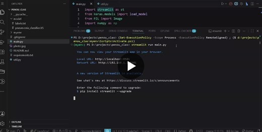 ‏#computervision #deeplearning #python #ai #learningjourney #github‏ | ‏Abdallah selim undefined‏ | ‏٢٠‏ من التعليقات