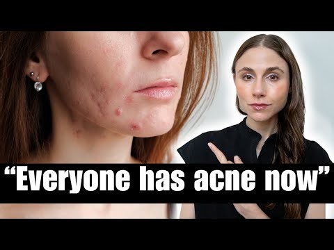 Why Does Everyone Have Acne Now? A Dermatologist Explains