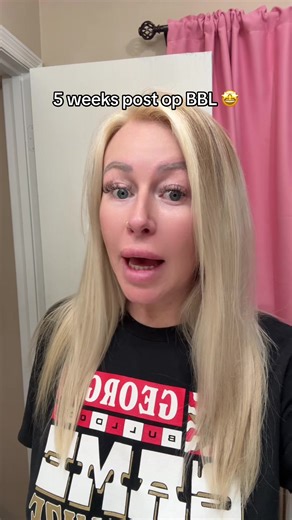 5 Weeks Post-Op BBL: Mia Aesthetics & Dr. Gray Update