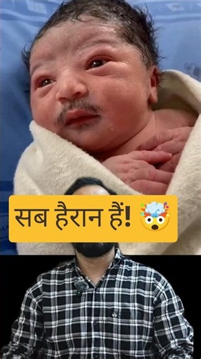 The Story Behind This Viral Mustache Baby