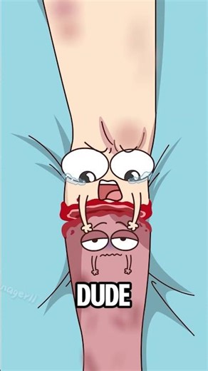 Why does the 'non-existent' limb still hurt after amputation?#shorts