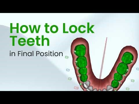 How to Lock Teeth in SmileInspector