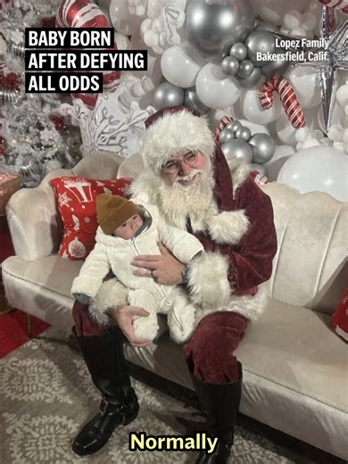 Rare Pregnancy Case: Nurse Surprises with Unexpected Birth