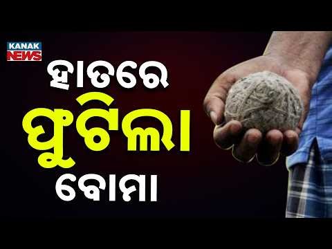 Bomb Explodes In Hand While Making, Palm Severely Injured | Shocking Accident Leaves