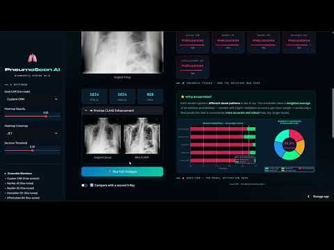 Multi-Model Deep Learning System for Pneumonia Detection in Chest X-Rays