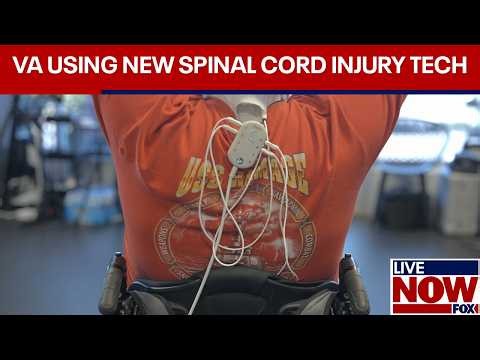 VA Adopts Breakthrough Spinal Cord Tech Funded by the Reeve Foundation