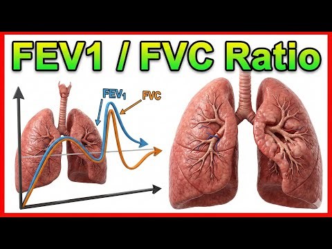 8. FEV₁ / FVC Ratio 🫁 Spirometry Interpretation in Obstructive & Restrictive Lung Disease | USMLE