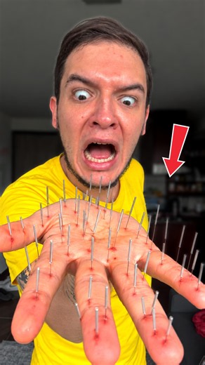 Mi Hijo Goku ME CLAVÓ 100 AGUJAS en LA PIEL !! 😱