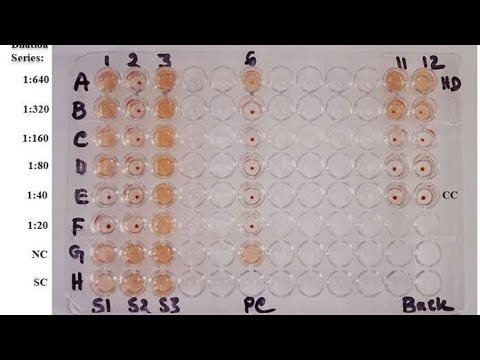 COMPLEMENT FIXATION TEST(CFT)