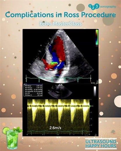 Complications in Ross Procedure